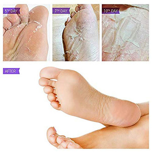 High Quality Exfoliating Spa Socks,Baby Skin Care Foot Peeling Mask Sheet