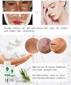 Natural Aloe vera Vitamin C Milk whitening skin Acne face wash massage pore cleaning Facial foam Cleanser
