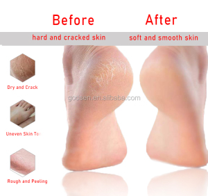 New Remove Hard Dead Skin Lavender Exfoliating Foot Peel Mask