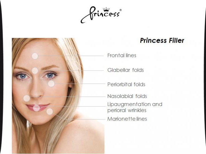 Princess Filler Hyaluronic Acid Filler HA Filler Dermal Filler made in Korea 