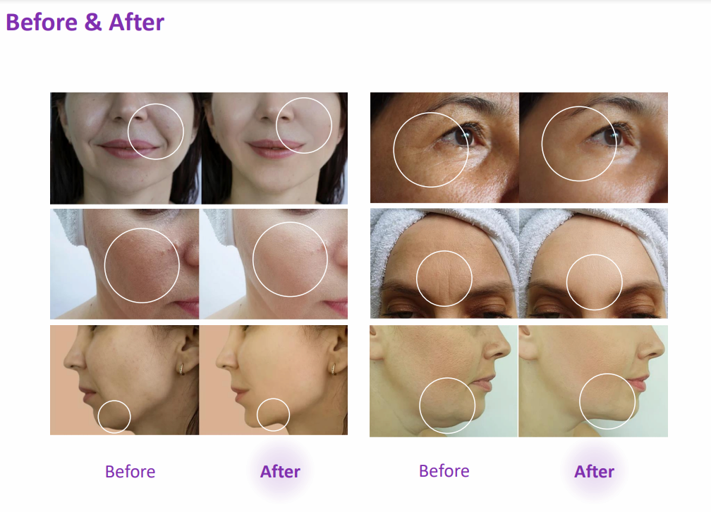 Selastin Exo Plus Exosome + PDRN Premium Skin Rejuvenation 