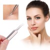 Professional Blackhead Remover Comedone Extractor 3 in 1 Stainless Skin Acne Blemish Whitehead Popping Removing Surgical Tools