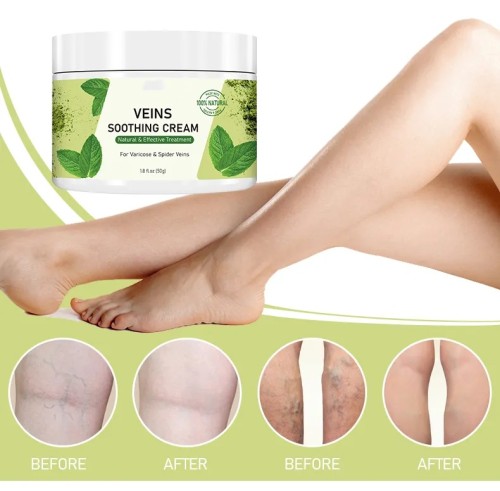 Customize Logo OEM Repair Vein Soothing Leg Cream Natural Varicose Veins Strengthen Capillary Health Veins Soothing Cream