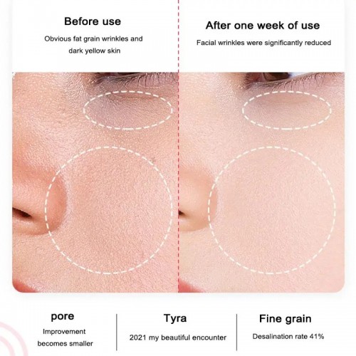 Ice Hammer Beauty Device Constant Temperature Hot & Cold Facial Massage Tool for Pore Shrinking Skin Care