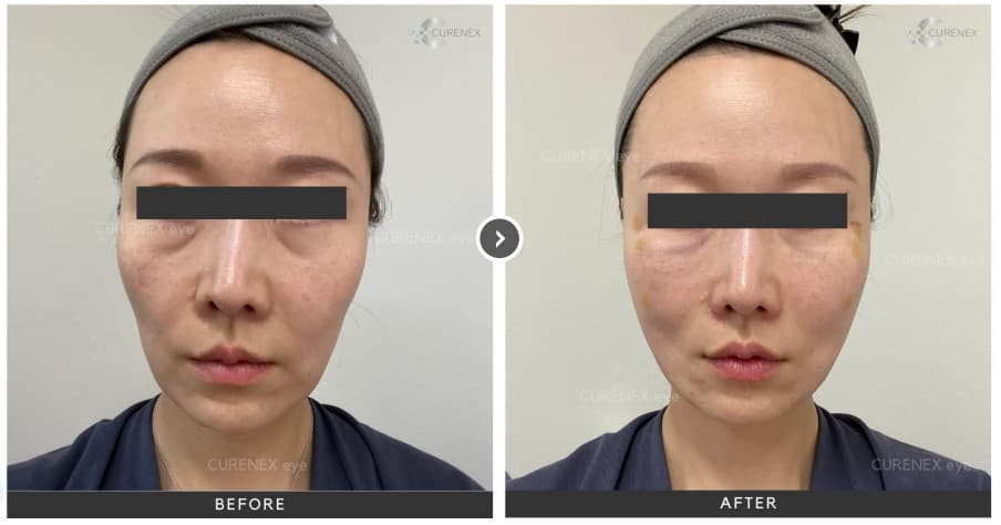 CURENEX EYE