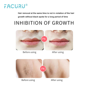 Facuru Professional Mini Silk Expert Hair Remover Home Use Hair Remover Machine Facial Hair Remover