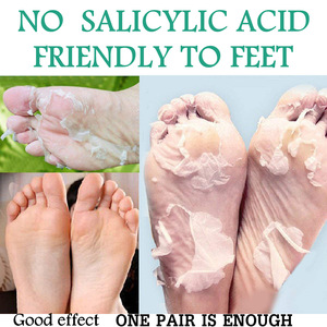 OEM ODM Peeling Feet Mask Exfoliating Socks Baby Care Pedicure Socks Remove Dead Skin Cuticles Suso Socks For Man Woman