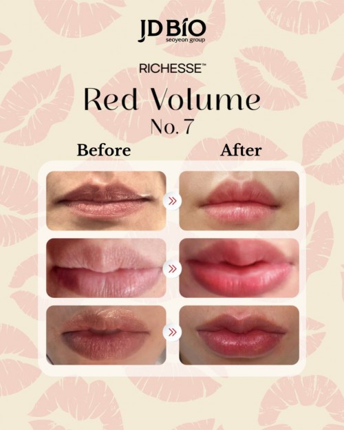Richesse Red Volume No.7 (natural red lips)