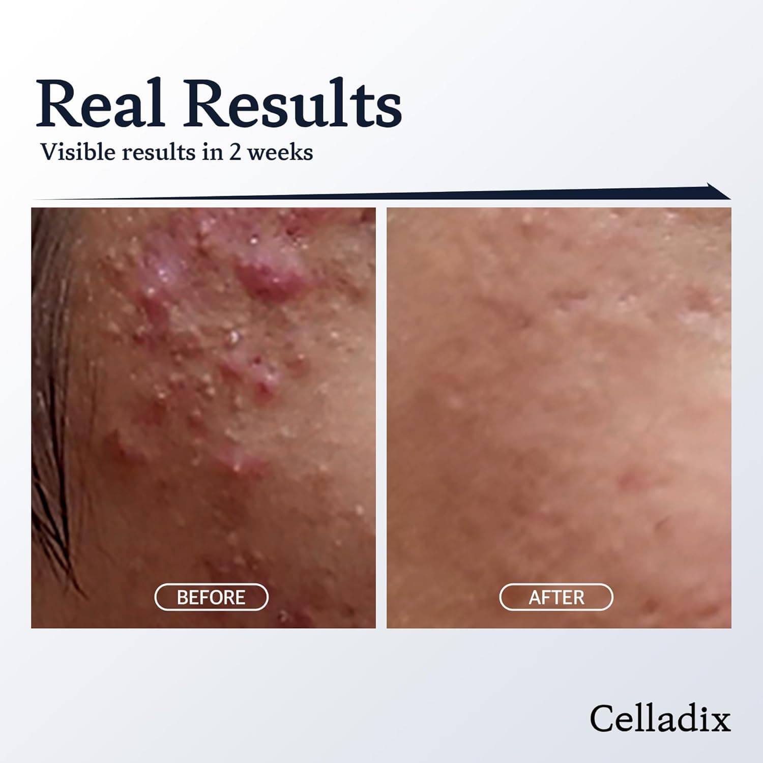 Sebum Rebalancing RX 131 Ampoule