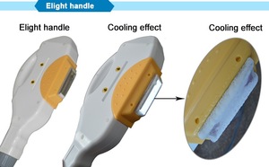 Suit all skin tones!!fast heat dissipation diode laser ipl 2 years longer warranty