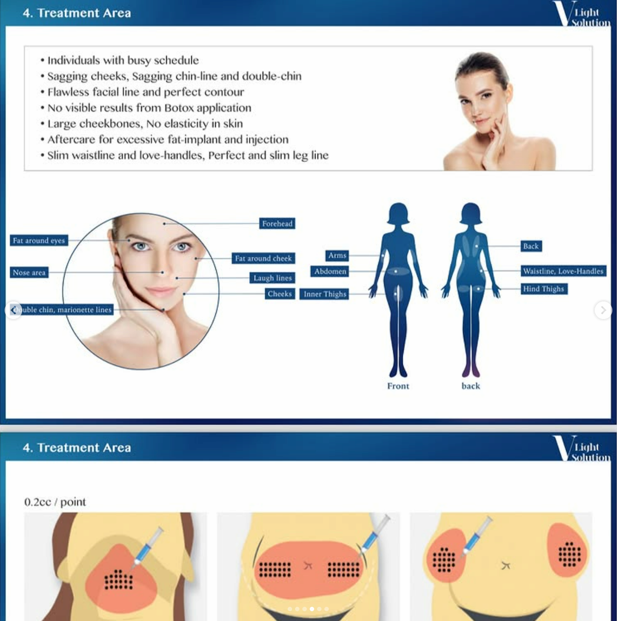 V light solution, the adupocyte cell wall is destroyed