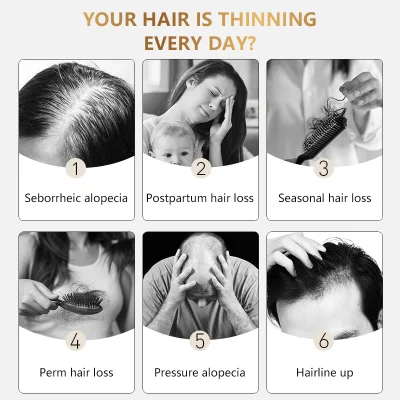 Hair Growth Serum for Men and Women Anti Loss Awaken Roots Repair Scalp for Hair Ginger Oil Biotin Serum