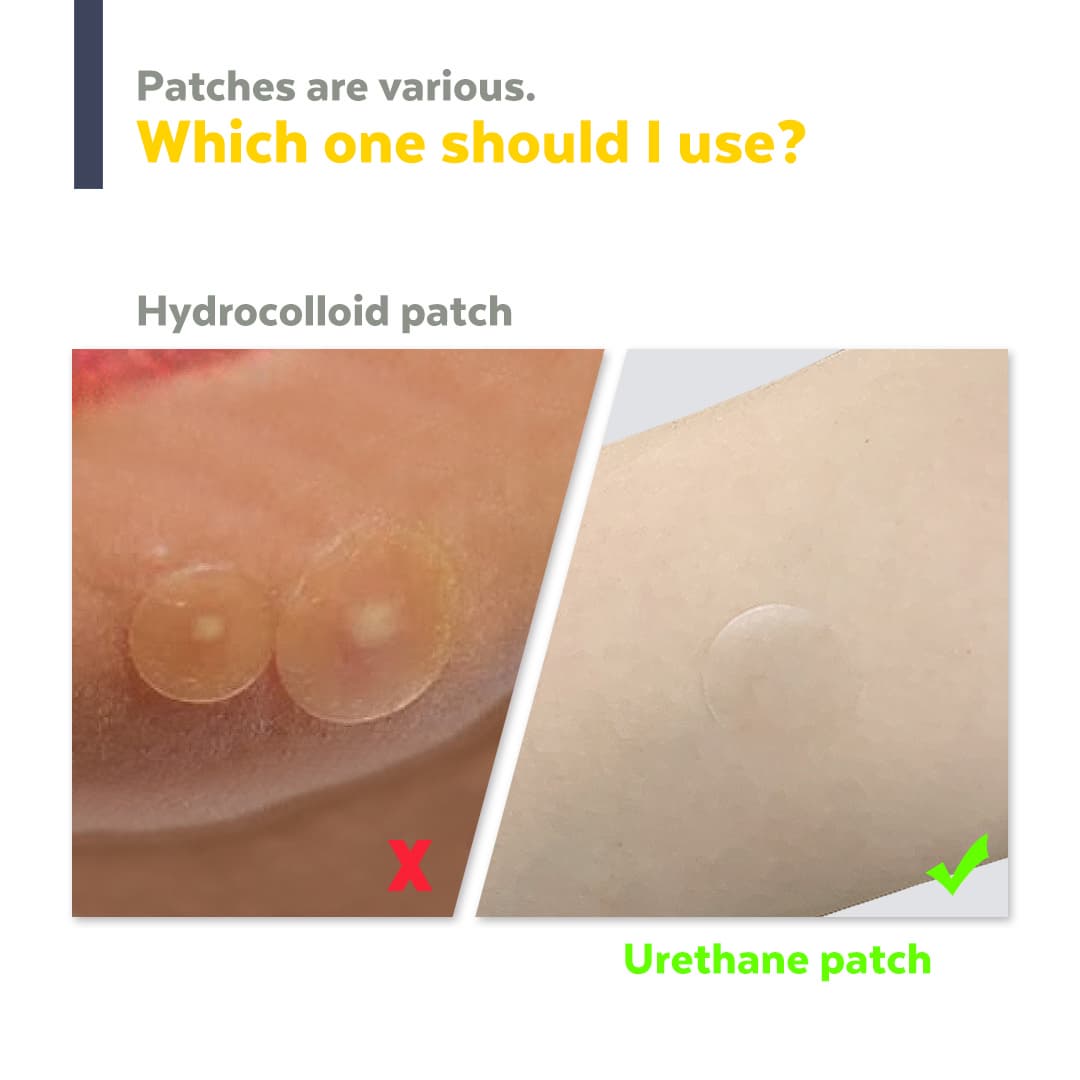 Hellocell Tea Tree Spot patch - Acne, pimple patch