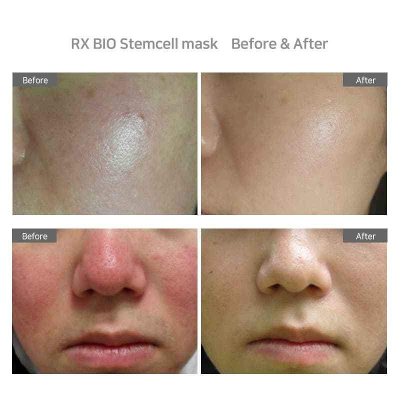  Moisture filling, soothing,stemcell mask,Bio mask,Whitening mask,anti-aging mask