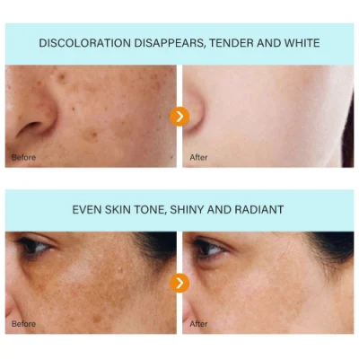 Wholesale Customize Own Brand Strong Whitening Freckle Cream Removal Melasma Dark Spot Melanin Remover Brighten Skin Face Cream