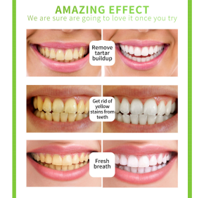 2021 hottest selling lanbena teeth whitening kit oral care teeth whitening serum teeth whitening pen lemon flavor