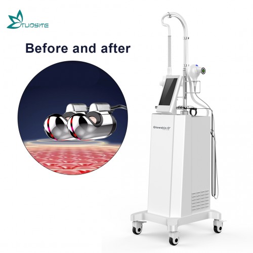 2021 Newest RF Superplastic Machine 360 Degree Rotation RF Fat Reduction Golden Finger Facial Lifting