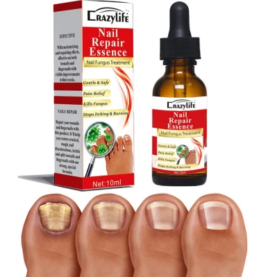 Spot Stock 10ml Effective Nail Repair Serum Essences Anti Fungus Remove Onychomycosis Toe Nourishing