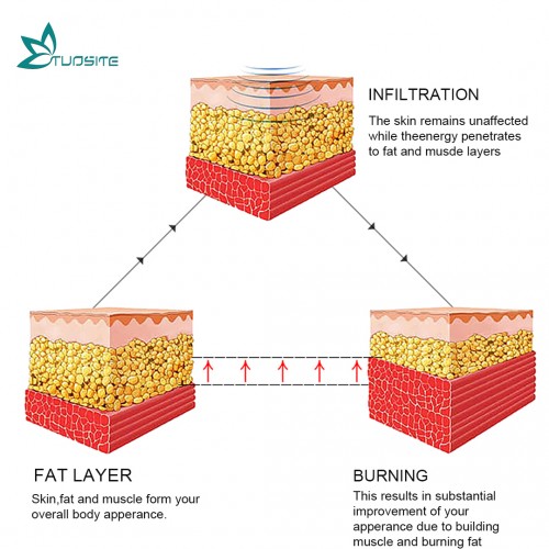 Design EMS Body Sculpting Fat Burner Hiemt Max 3 Machine Fat Burning