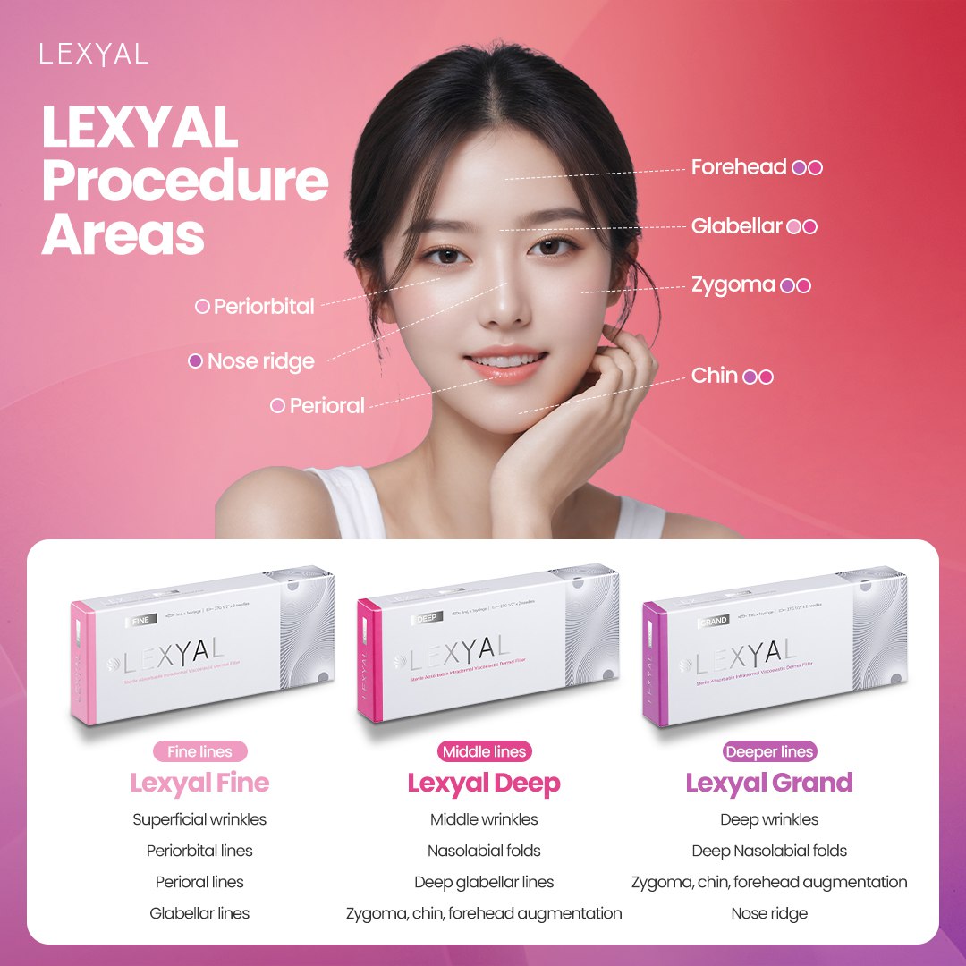 LEXYAL Fine, Deep, Grand (CE)