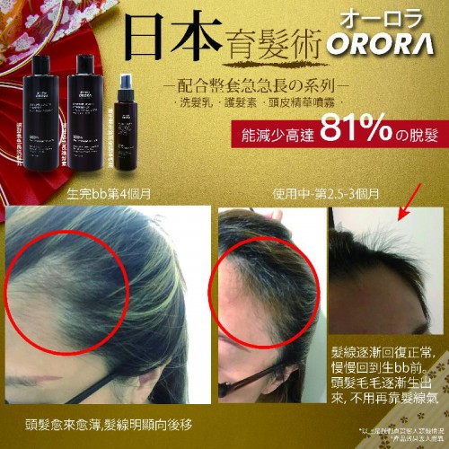 Extreme Length Anti  Hair Loss Conditioner