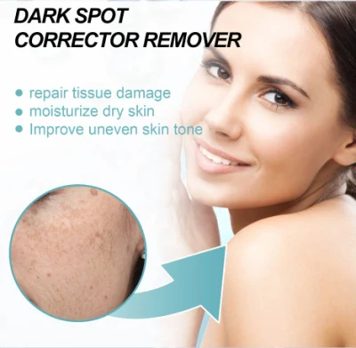 Collagen Cream Whitening Freckle Cream Melasma Remove Legs/Arms Face Dark Spot Corrector Cream