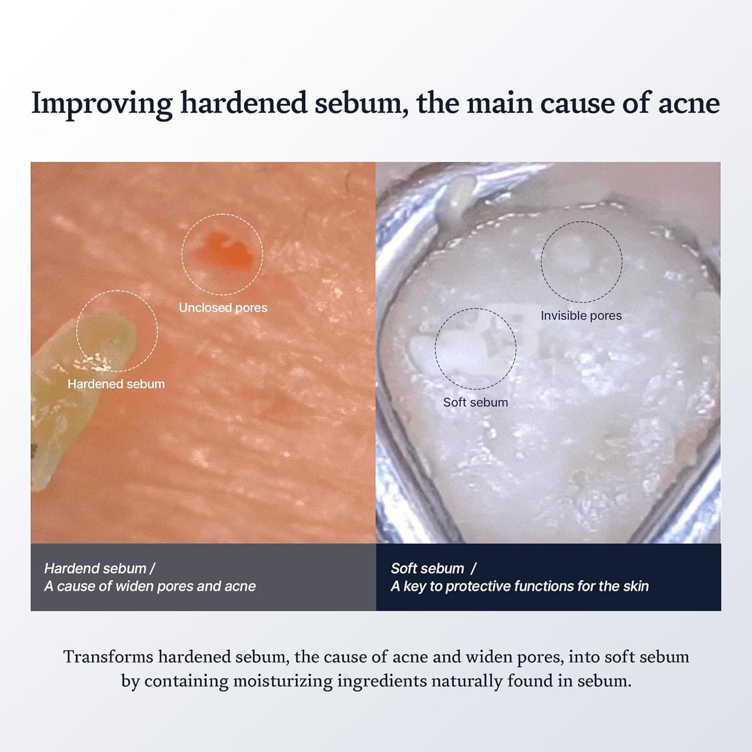 Sebum Rebalancing RX 131 Ampoule