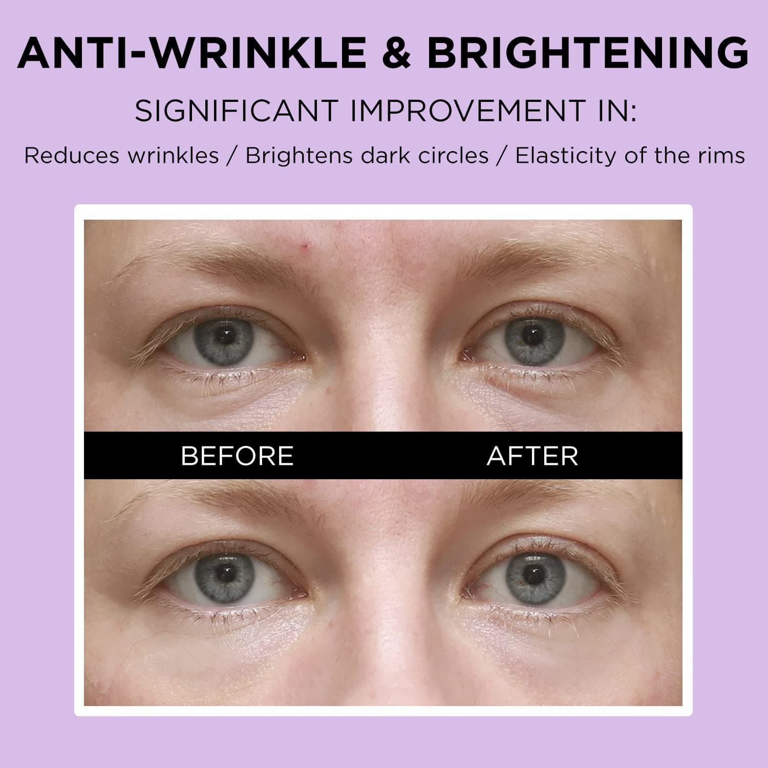 VARIHOPE Biotics Vital Eye Cream