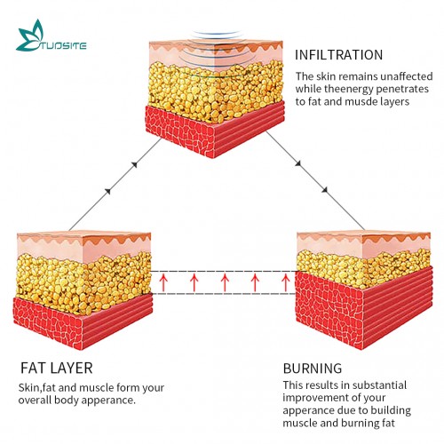 EMS2 Fitness Hiemt Electromagnetic Beautiful Mulscle Cellulite Removal Machine 2 Handle Hiemt Fat Burning