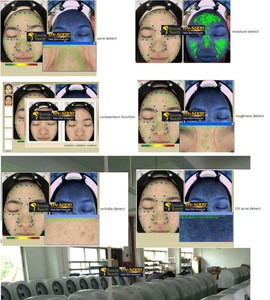 Facial skin analyzer machine