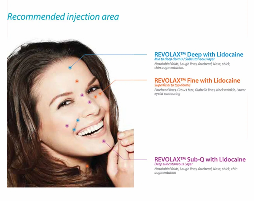 Revolax Fine ,Dermal filler, HA filler