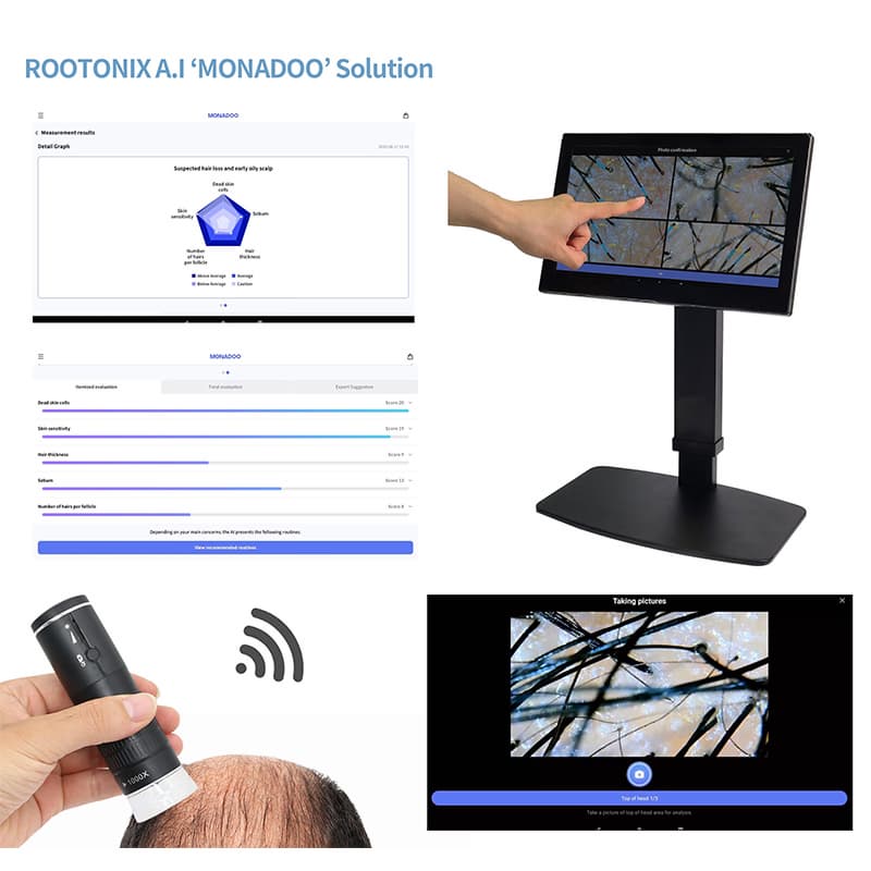 ROOTONIX A.I Scalp Diagnostic Service with MONADOO