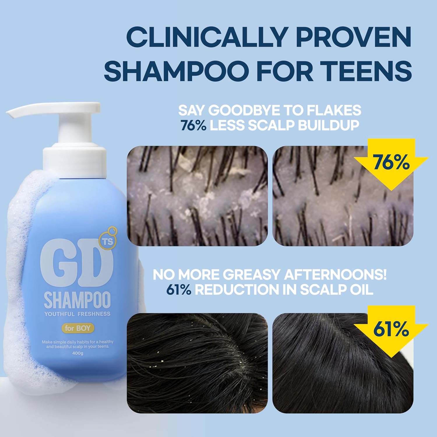 TS GD Shampoo for Flake Prone, Uncomfortable Scalp (14.1 Fl Oz) For Youth &amp; Teens  Gentle Scalp-Car