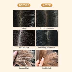 hair treatment hair shampoo and conditioner private label keratin collagen hair black shampoo
