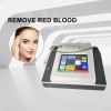 Mini 980 Nm Diode Laser Spider Vein Removal Vascular Removal Laser Beauty Equipment