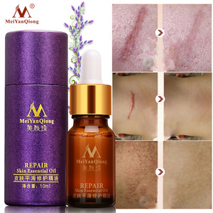 MEIYANQIONG Skin Care 100% Pure Natural Organic Stretch Marks Scar Removal Lavender Essential Oil 10ml