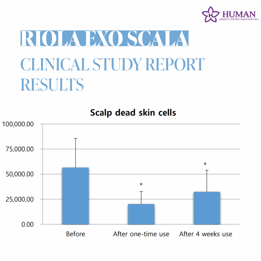Riola Exo Scala Hair Loss Relief