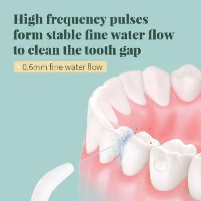 Efficiently Stepless Speed Oral Irrigators Without Hurting Gums for Cleaning