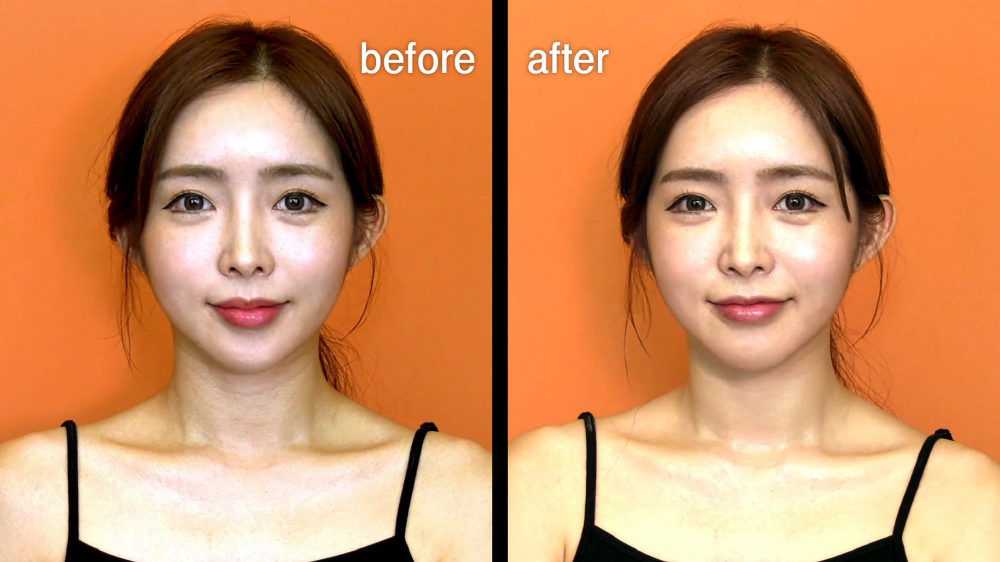 My Formula My Neck Mask