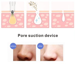 Portable beauty skin care deep pore vacuum blackhead remover tool