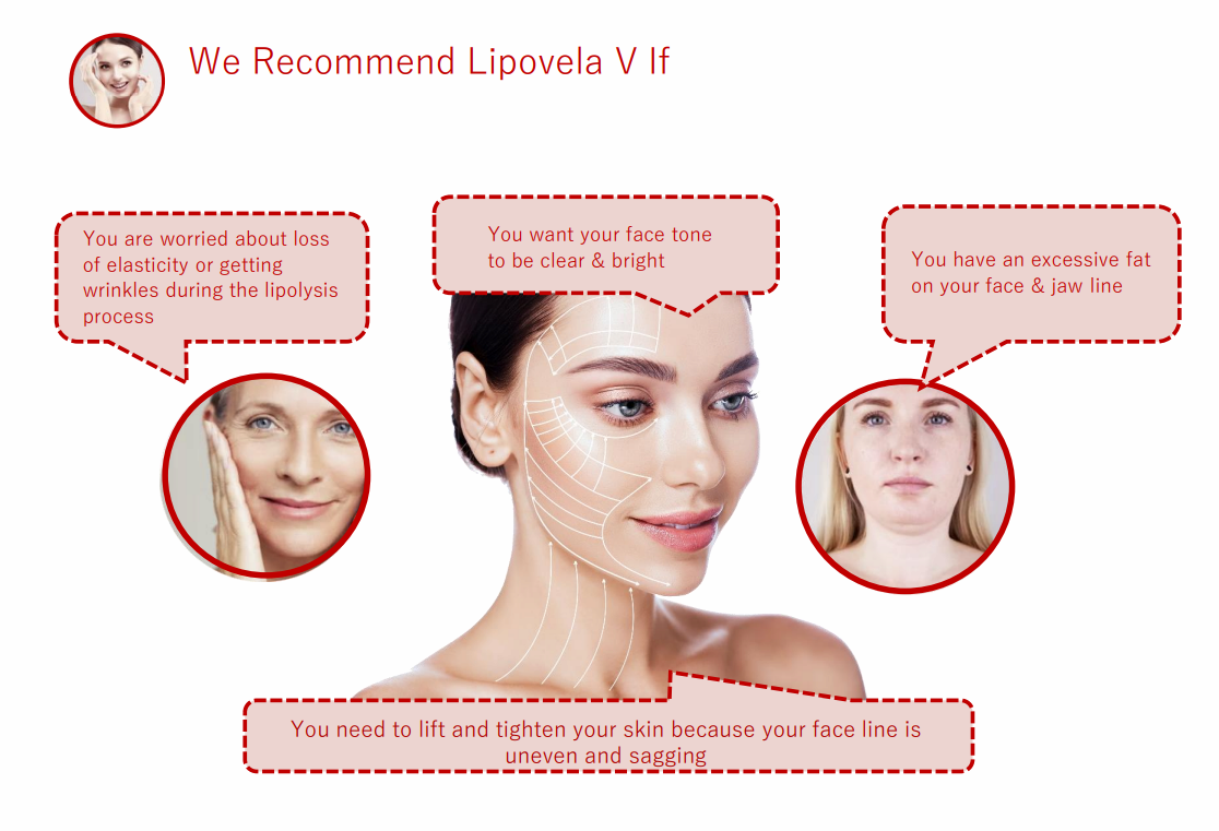 LIPO VELA - V Premium Lipolysis Solution with a Whitening &amp; Lifting Effect, Beautiful V-line