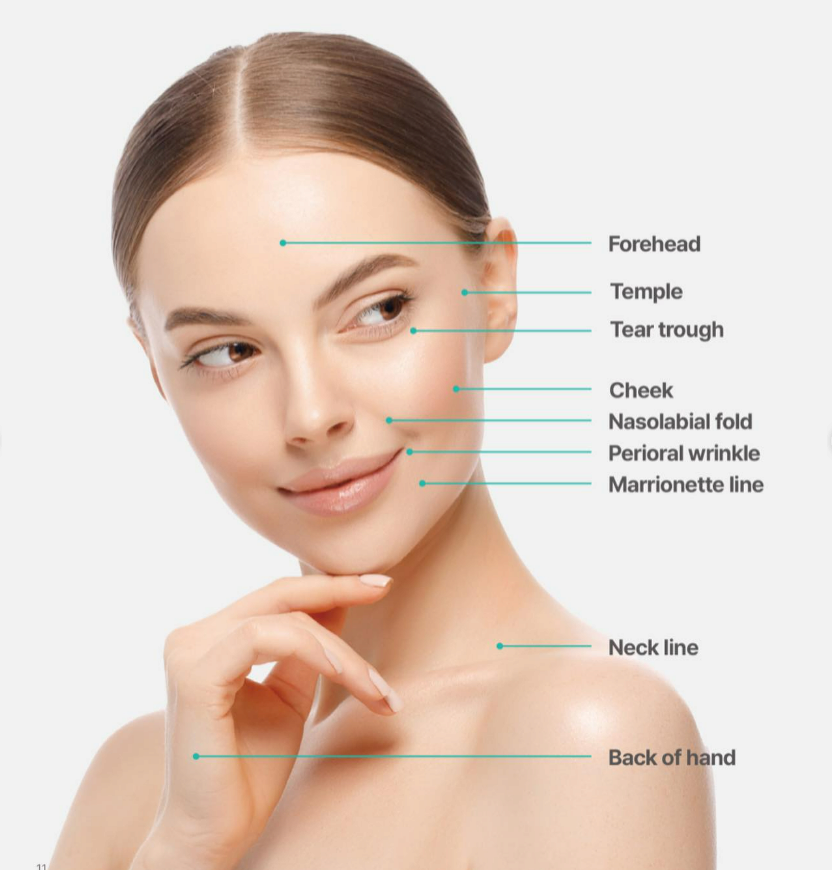 THE PILLA  365mg  Poly-l-lactic Acid Collagen, Volume 