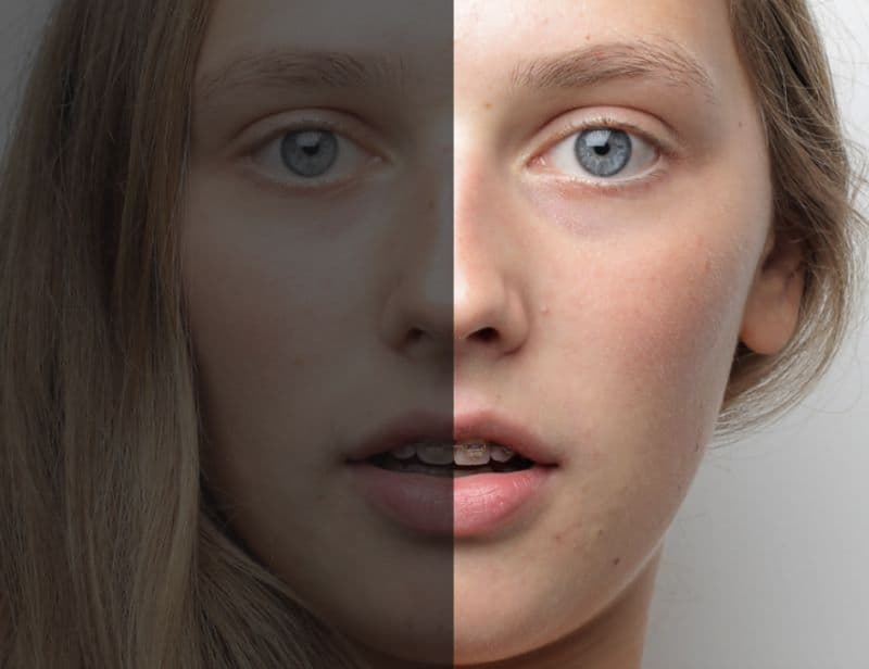 Vitamin freckle Cream
