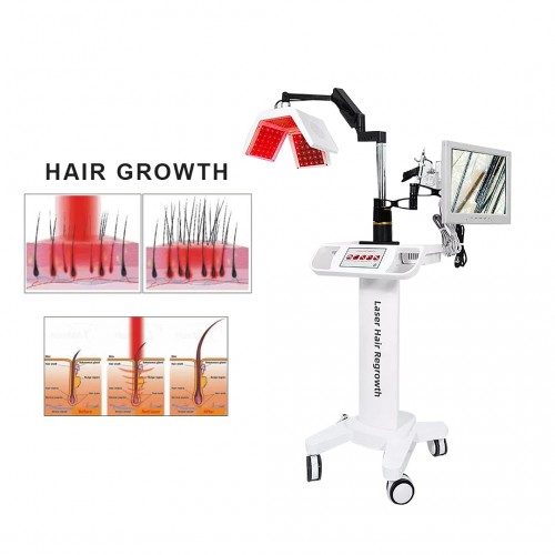 Popular Hair Regrowth Laser Machine 650nm Diode Laser Medical Equipment