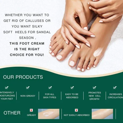 Custom High Quality Foot Care Foot Repair Cream Rough Thick Dry Cracked Skin Calluses Feet Cream 100g