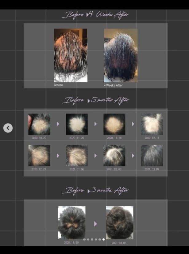 HAIRNA HAIR CARE TREATMENT TONER SHAMPOO  