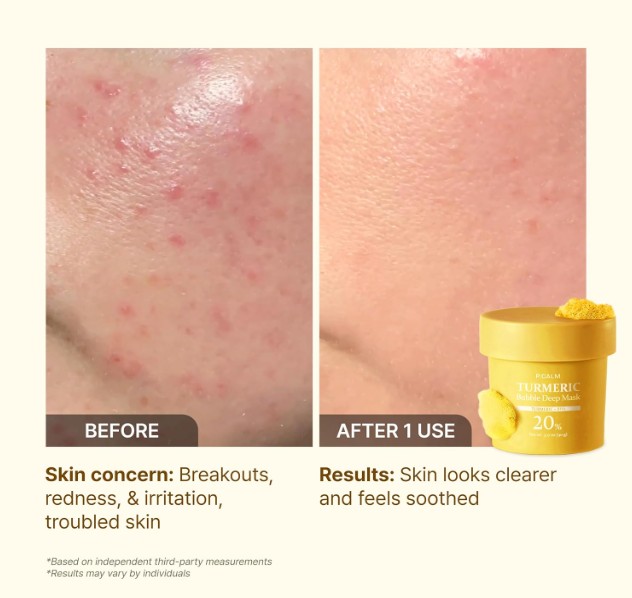 P.CALM TURMERIC Bubble Deep Mask