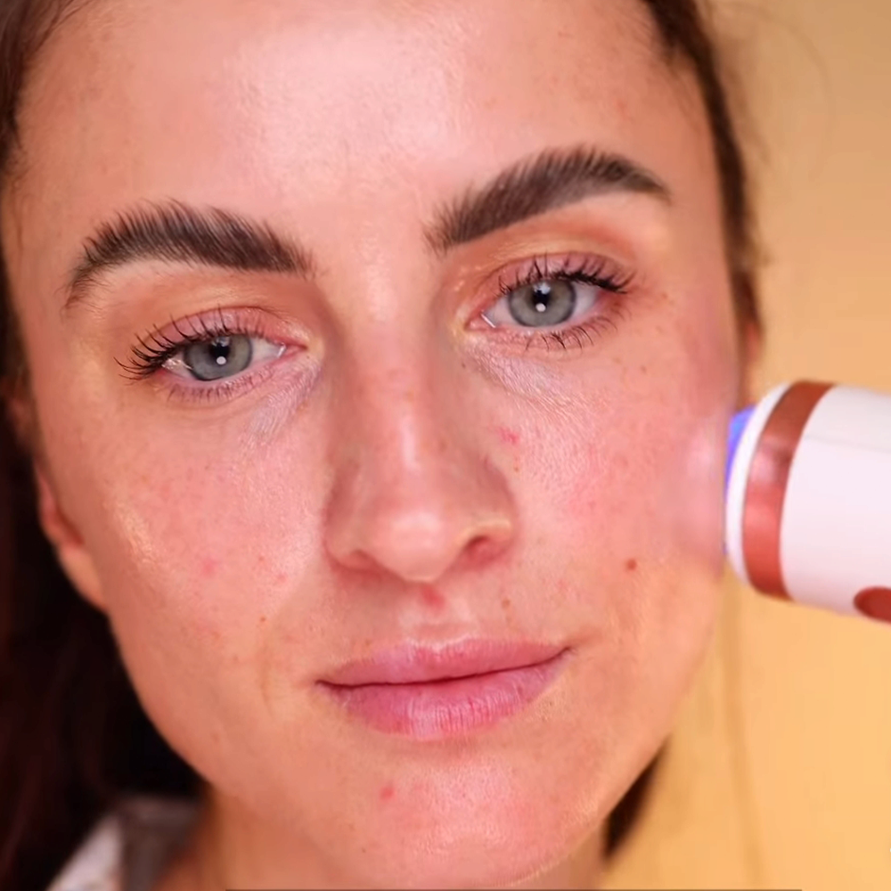 PLINIC Single - Plasma Beauty Device for Skin Care and Personal Beauty