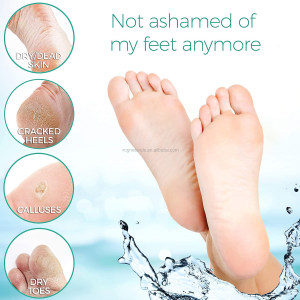 Private Label Foot Peel Mask Smooth Skin, Removes & Repairs Rough Heels Exfoliating Peeling Natural Treatment Foot Mask