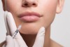 Where to Buy Allergan Botox 100 iu Online Zoraskincare.com